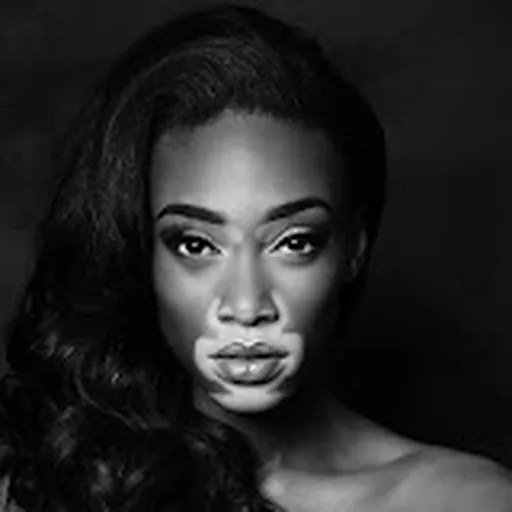 Winnie Harlow